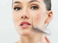 jenis macam metode prosedur treatment perawatan klinik dokter estetika kecantikan mengatasi menghilangkan jerawat acne therapy proses berapa harga kulit wajah mulus skincare