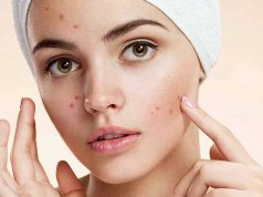 Jenis macam obat krim ips cara menghilangkan jerawat acne treatment dokter klinik kecantikan