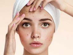 Tips cara paling efektif terbaik menghilangkan menyembuhkan jerawat acne treatment